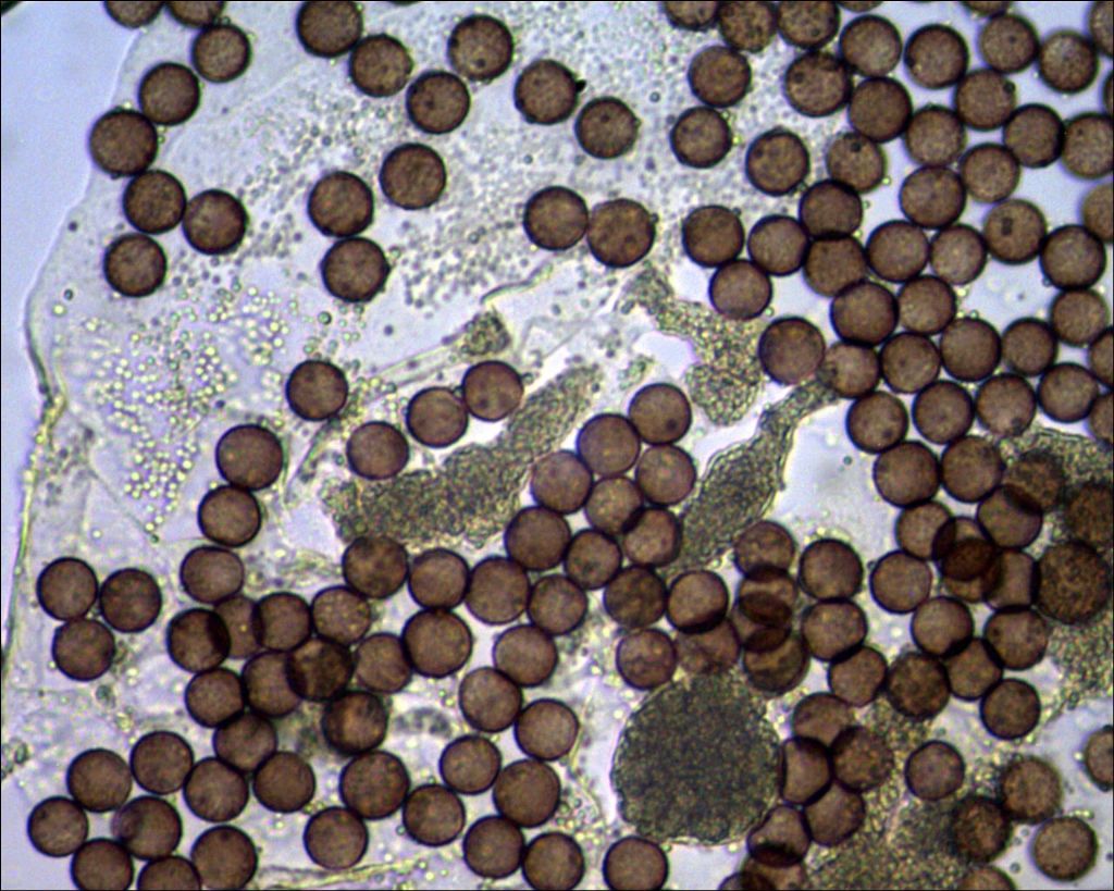 Badhamia or Physarum?